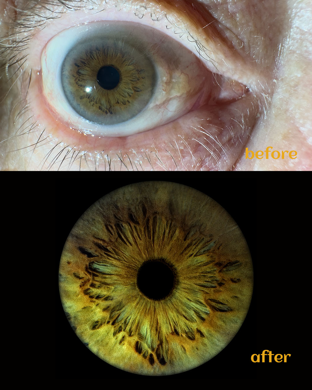 Striking iris