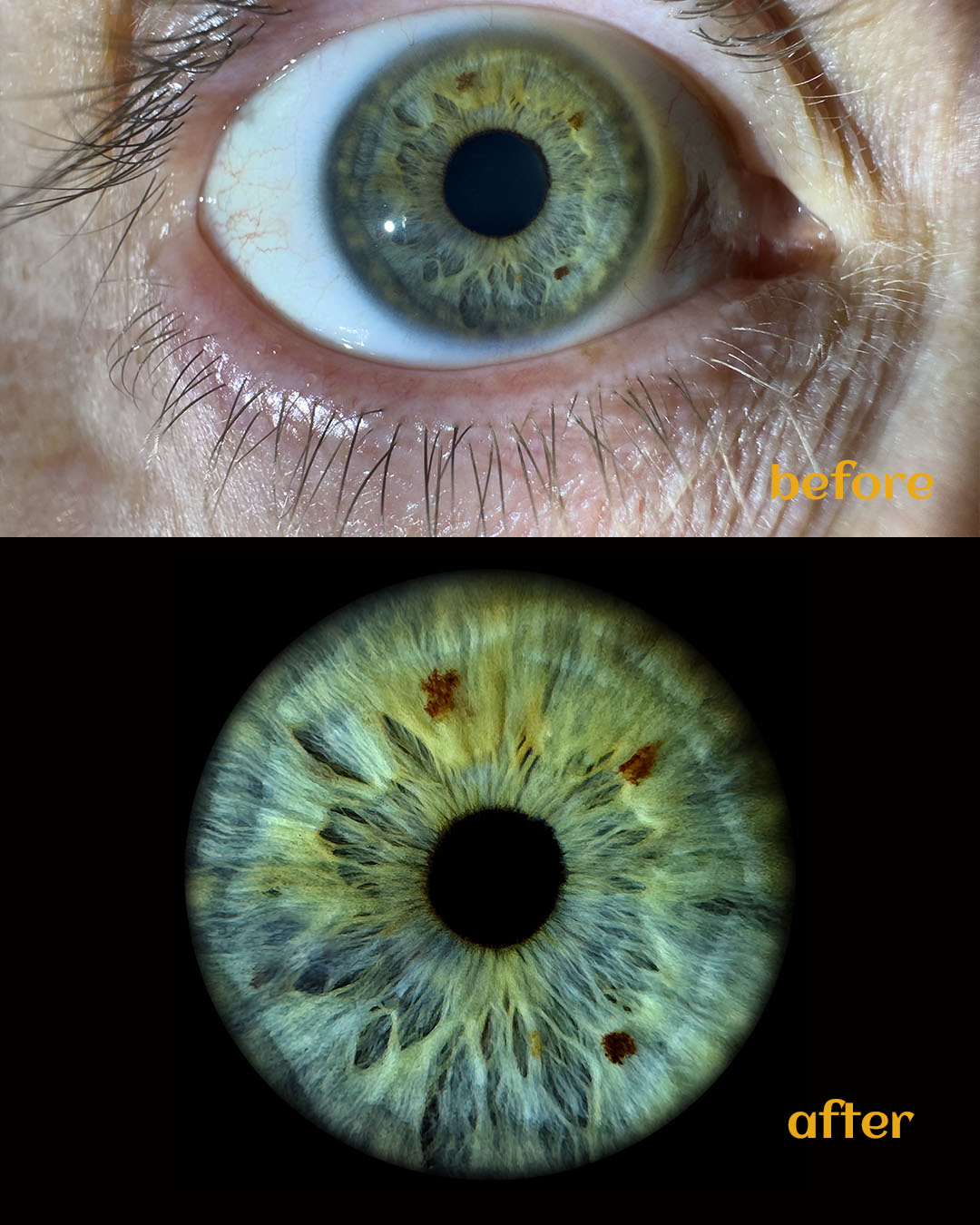 Detailed iris