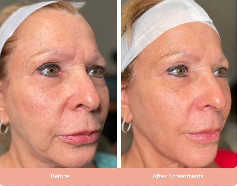 Client result example