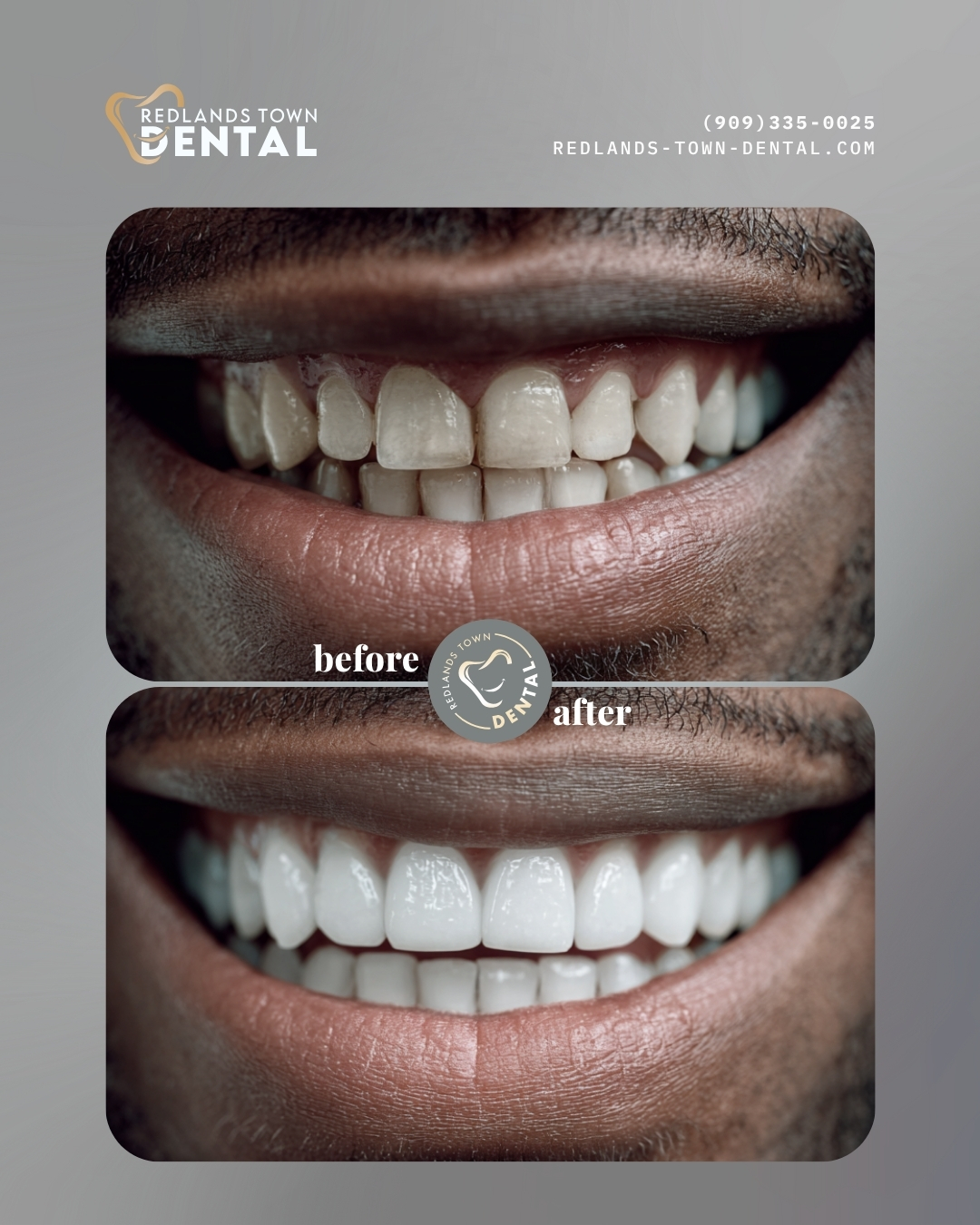Waiting room with comfortable seating at Redlands Town Dental