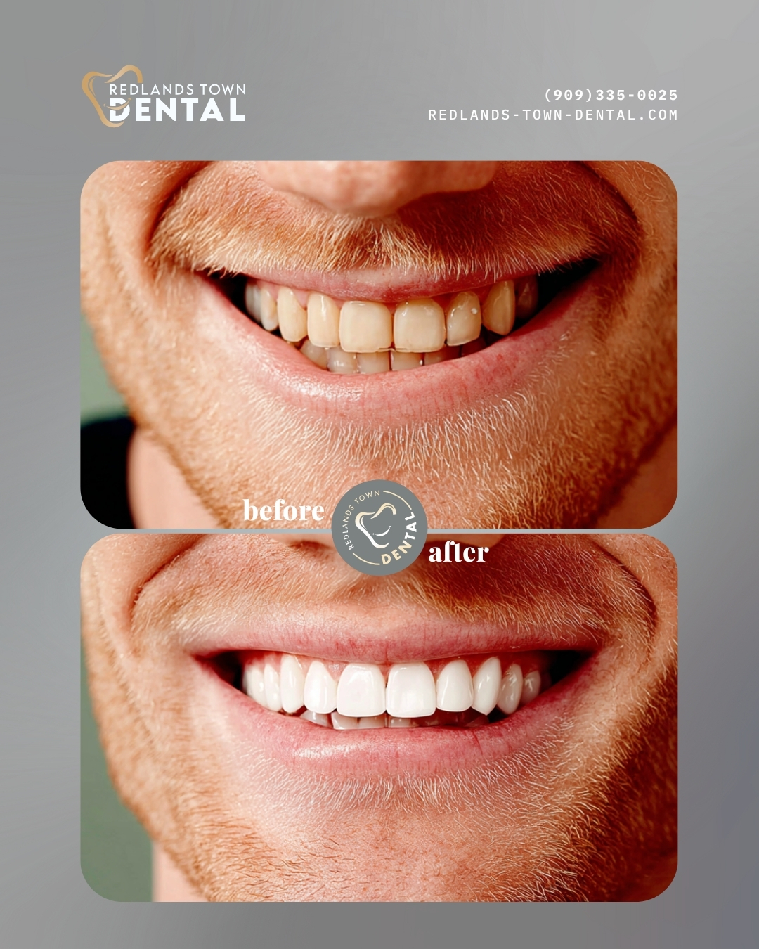 Waiting room with comfortable seating at Redlands Town Dental
