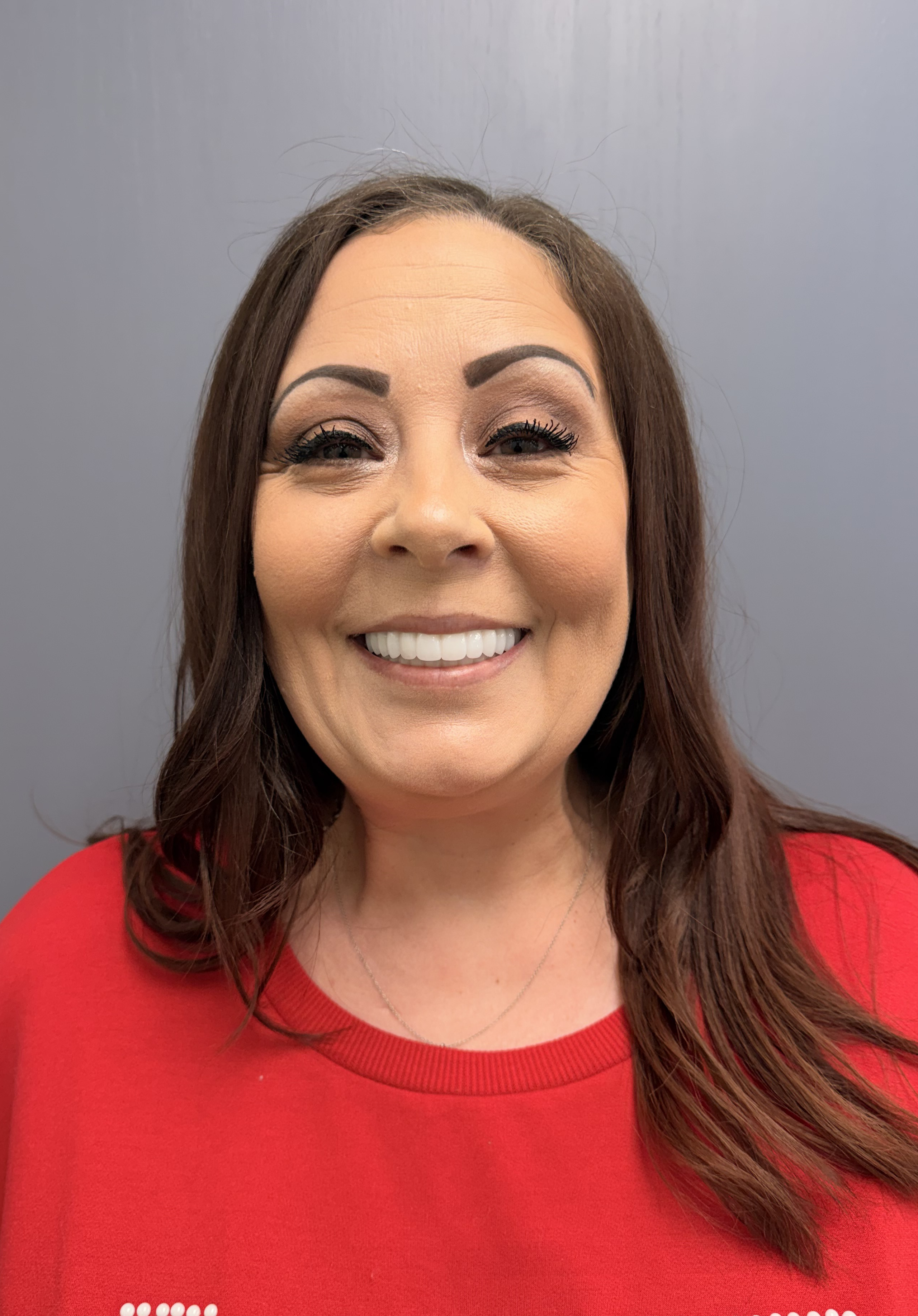 Patient smile after dental implant treatment