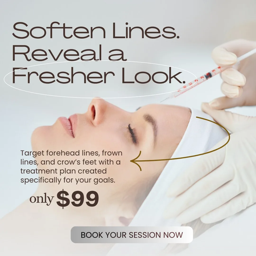 A BiteBot for Medical Botox ad with the headline Soften Lines, Reveal a Fresher Look.