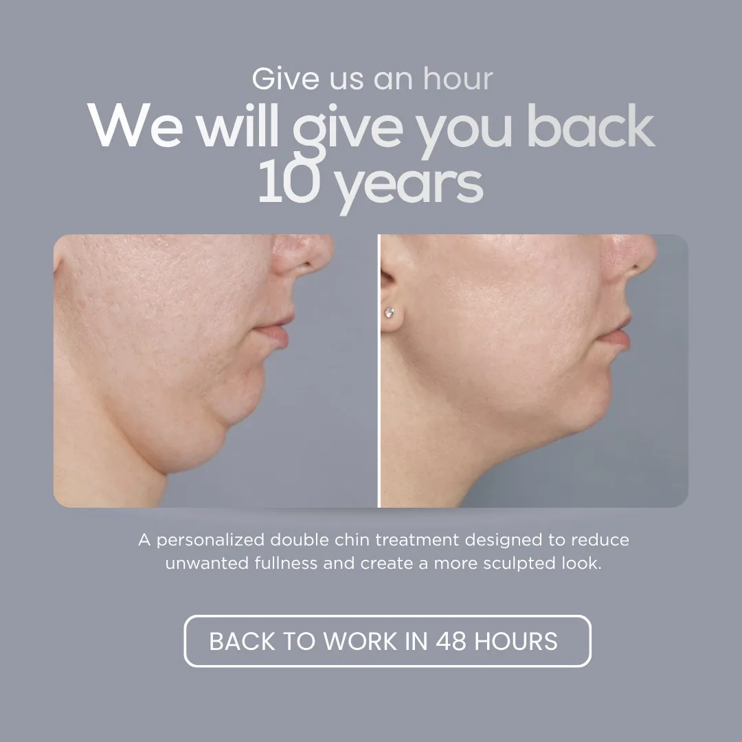 A BiteBot for Medical double chin treatment ad with before-and-after comparison.
