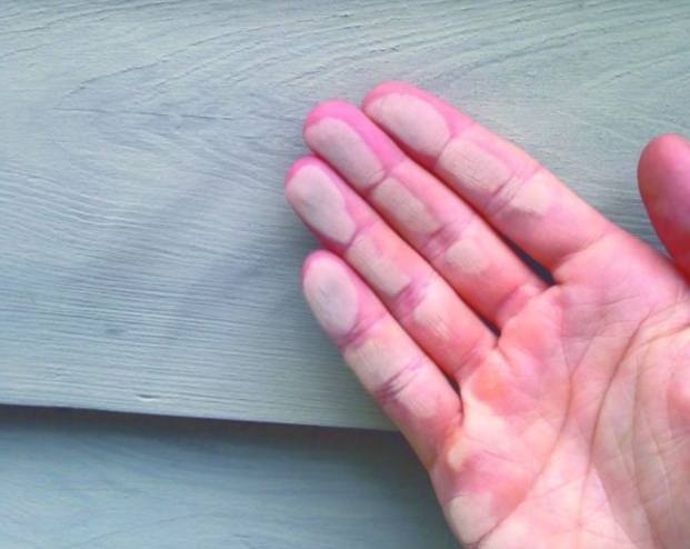 Worn wall paint showing clear signs your home needs a fresh coat of paint