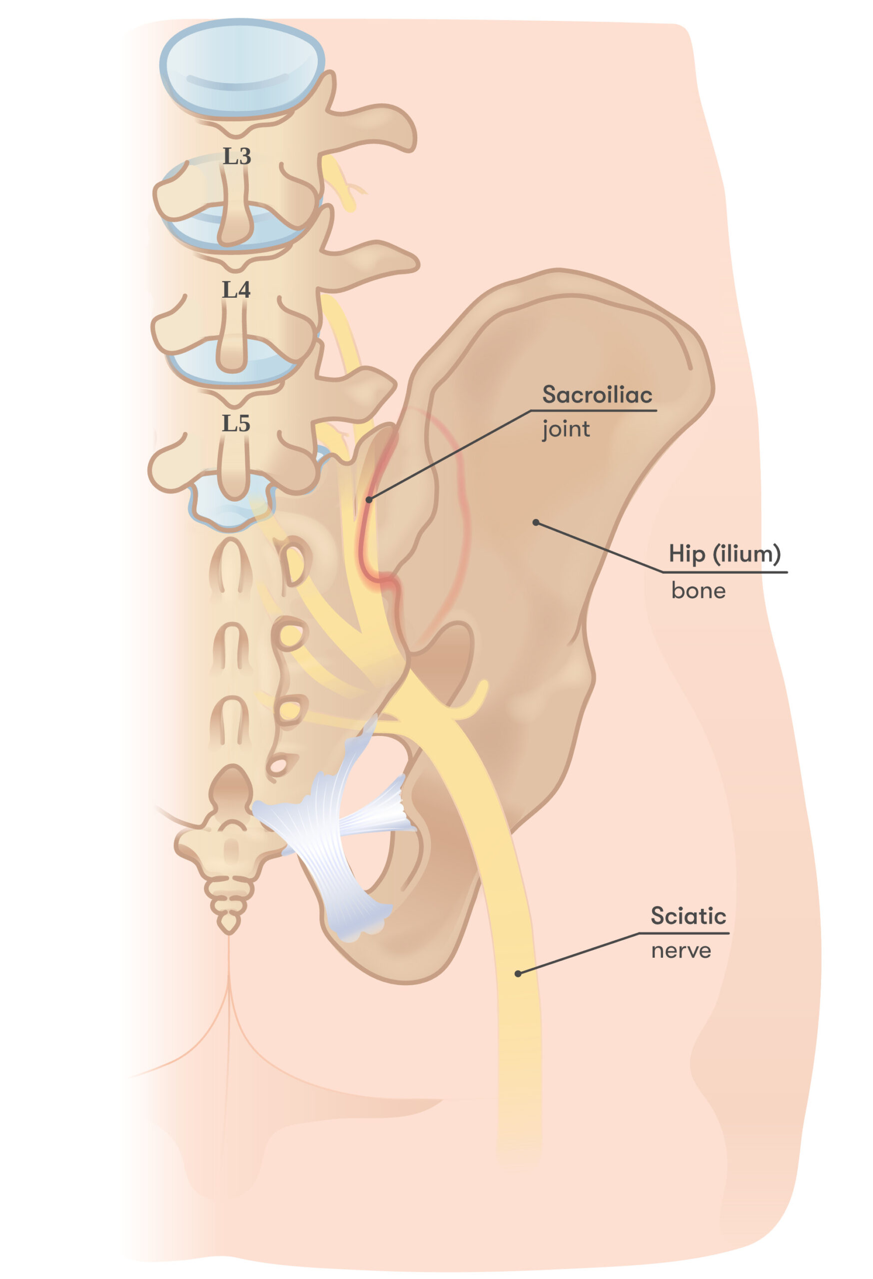 Diagram of Sciatic Nerve running through pelvis illustrating sciatica and back pain