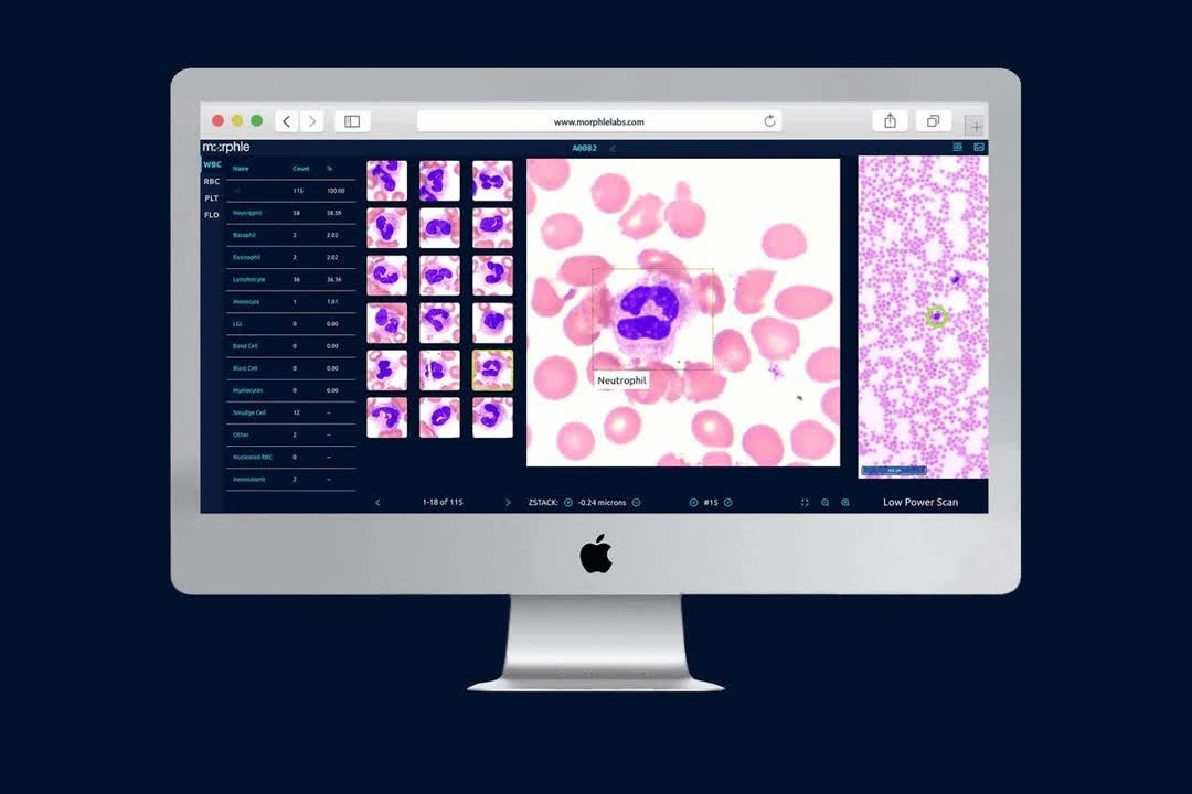 Hemolens 1 hematology imaging system