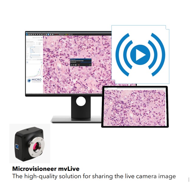 MVLive telepathology system