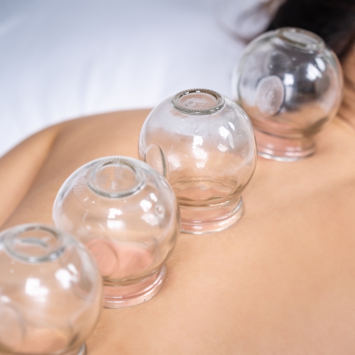 Cupping therapy in Ottawa and Orléans