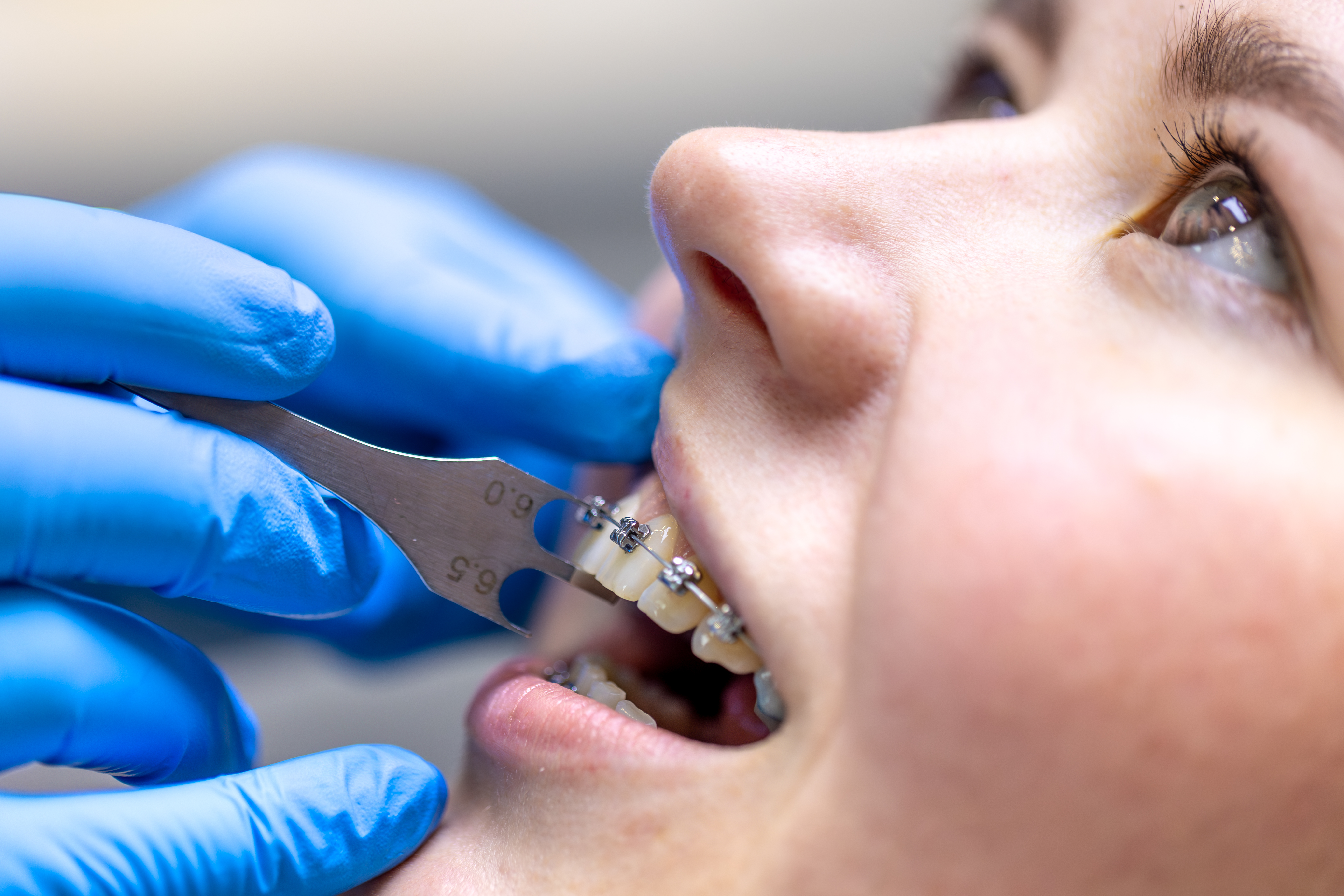 Expert Orthodontist Treatment in Changanassery