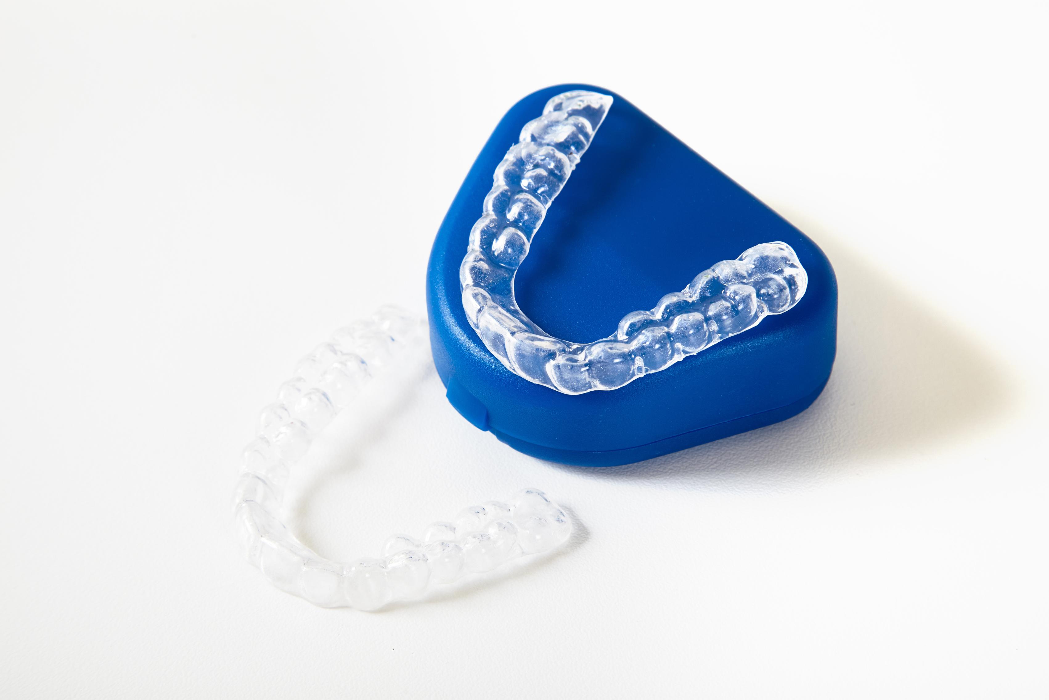 Invisible Aligners in Changanassery