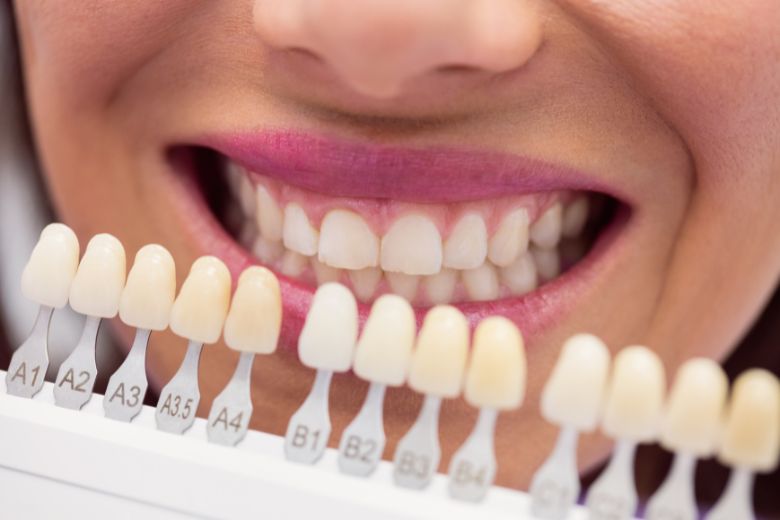 Cosmetic Dental Treatment Changanassery