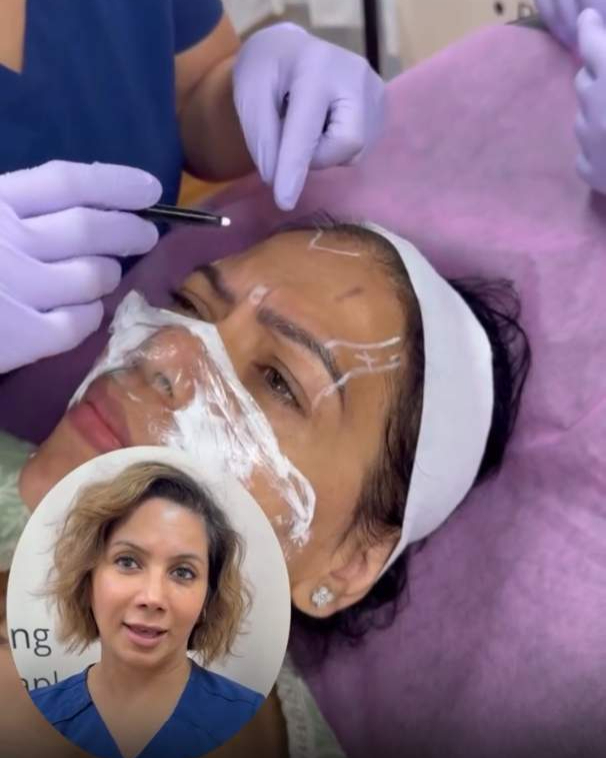 Microneedling & PRP Session