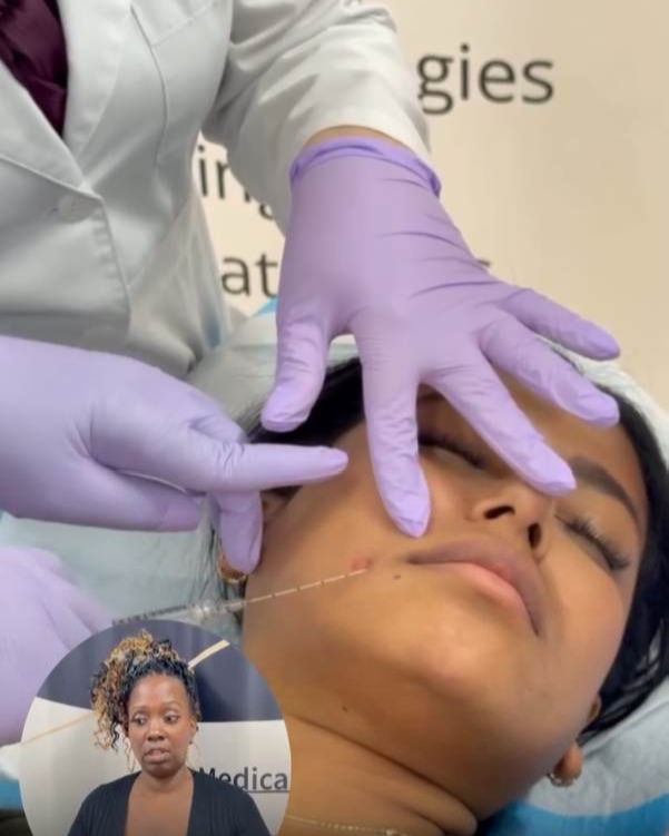 Neurotoxin Injection Demo