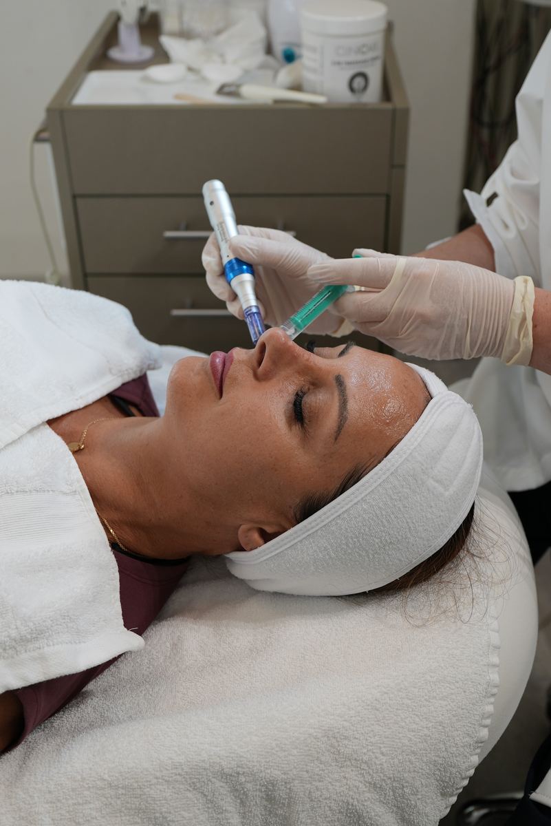 microneedling