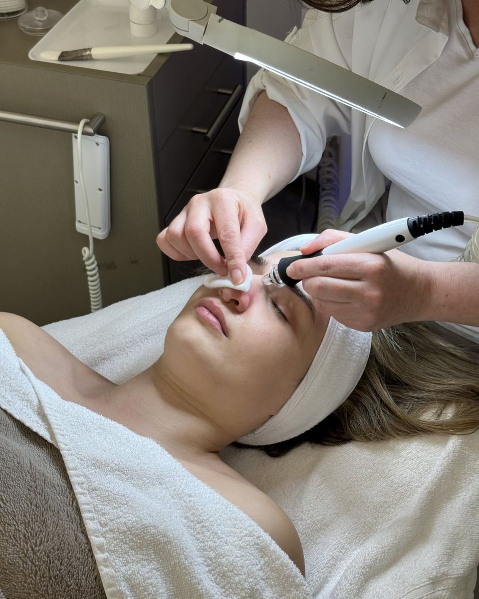 profacial