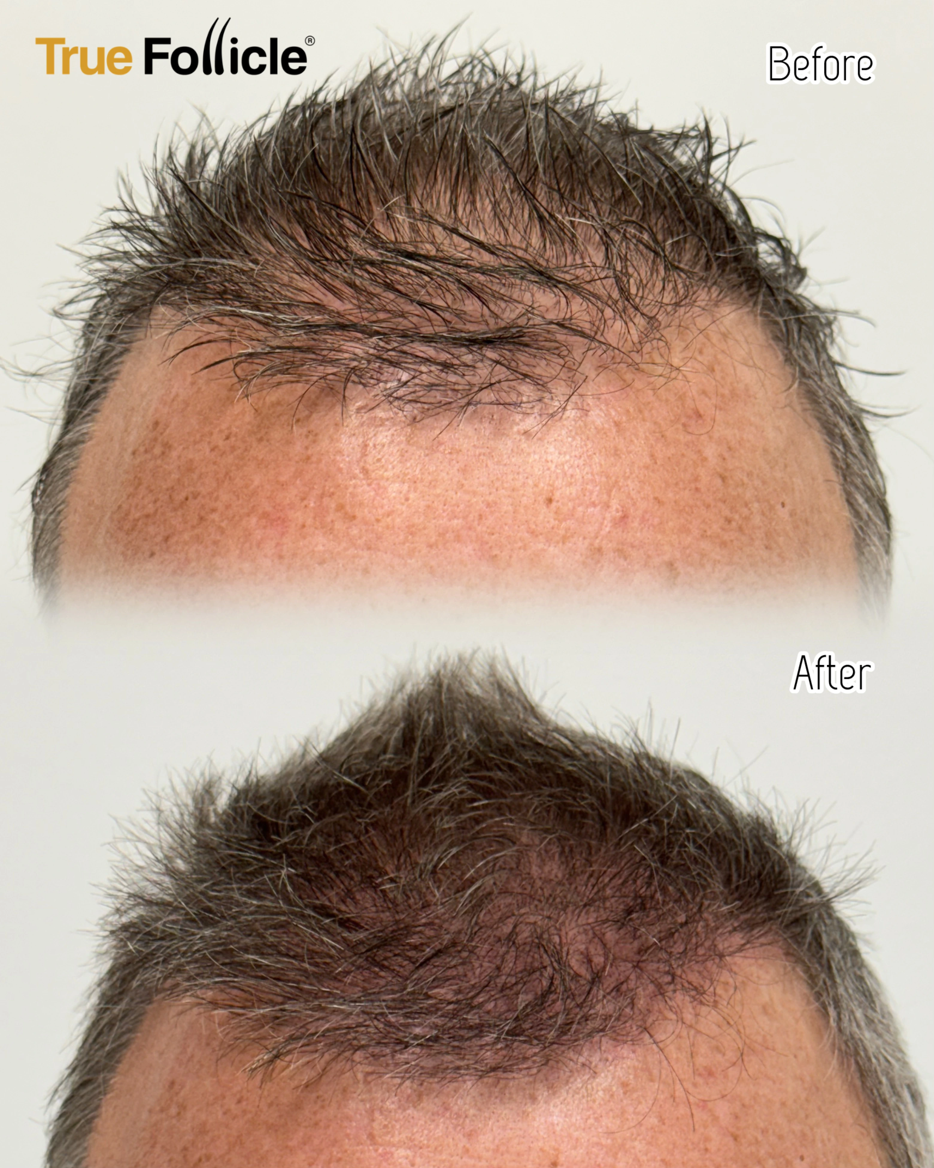 Fusion Brows gallery image 12
