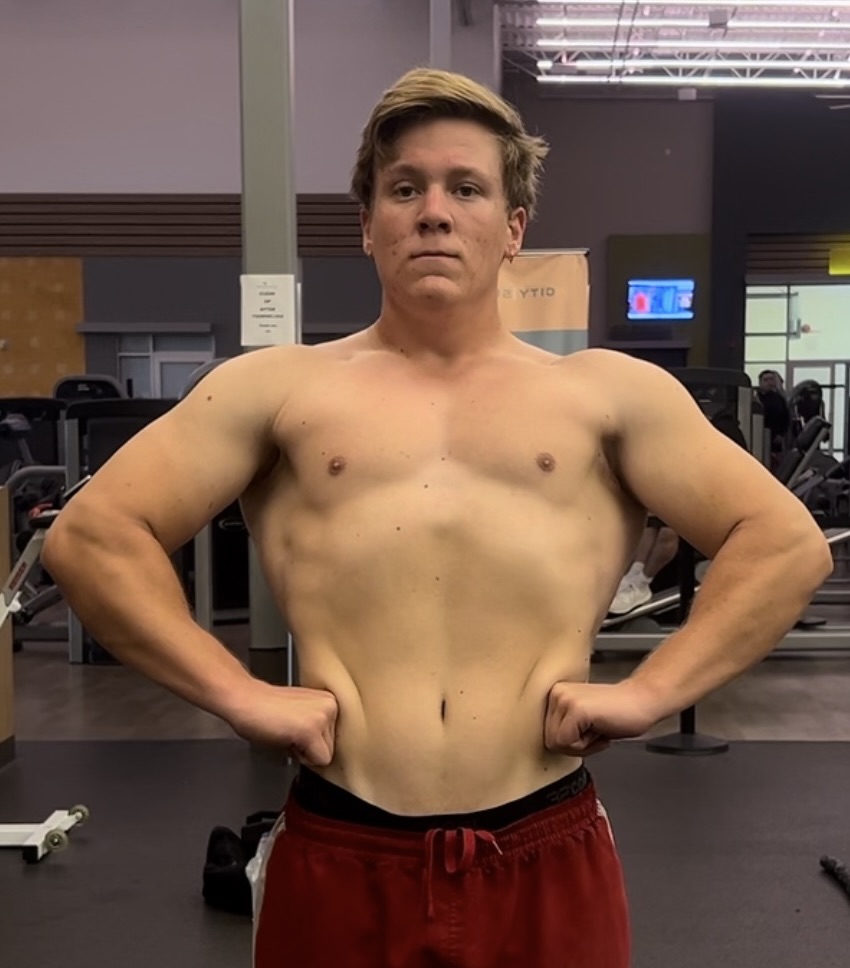 Bronson before photo
