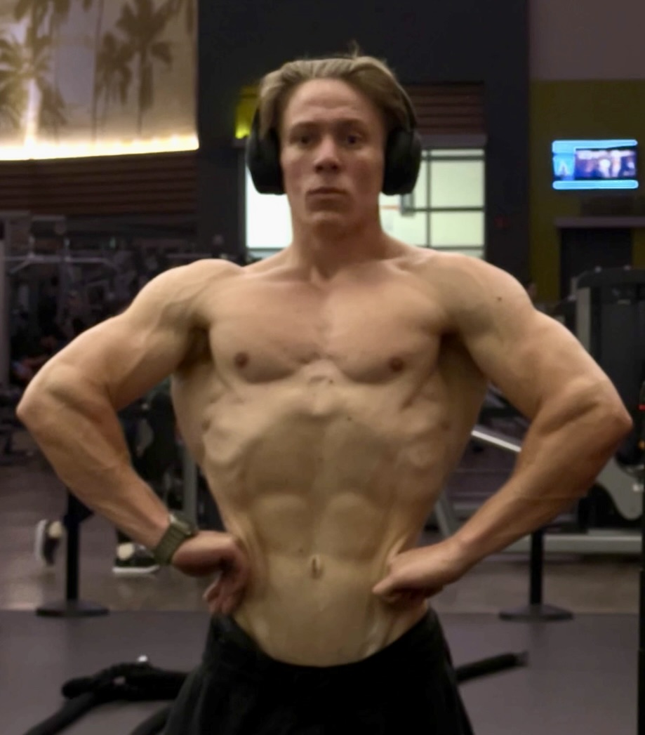 Bronson after photo