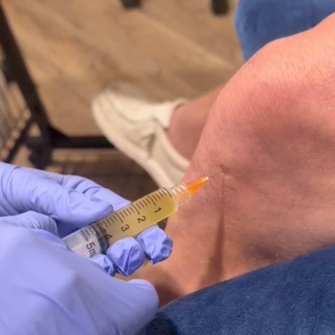 Nurse Practitioner performing Platelet-Rich Plasma therapy