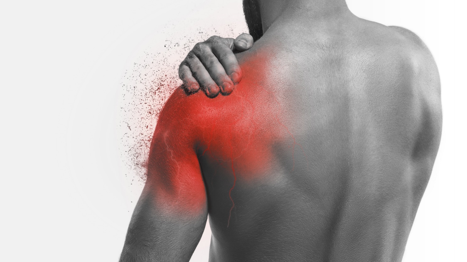 Burning and shooting nerve pain