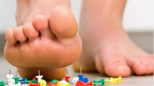 Tingling and pins-and-needles in the hands