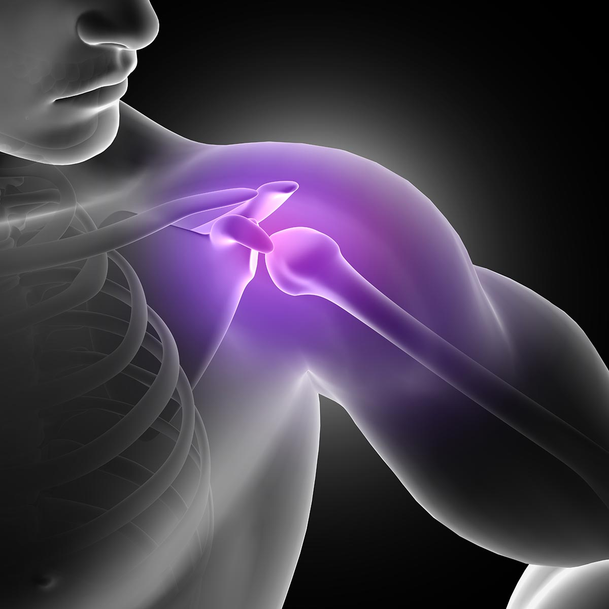 Rotator cuff injuries