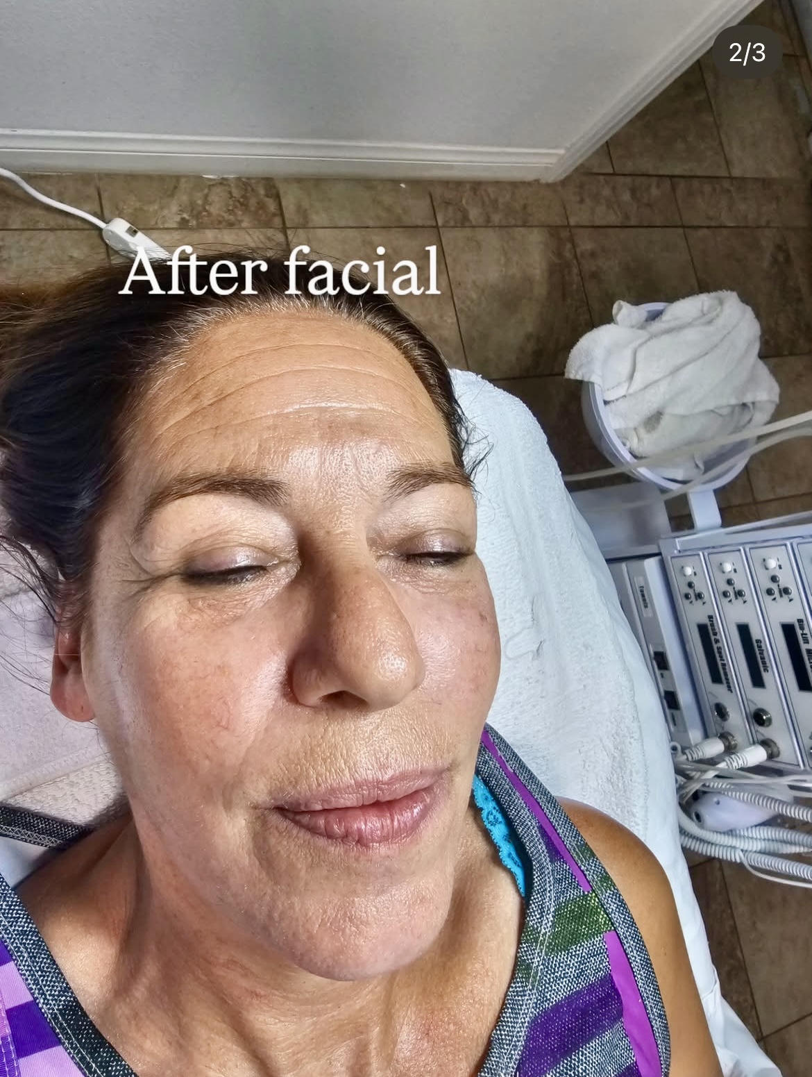 Regular HydraFacial Client