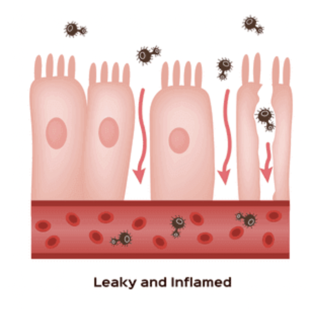 Illustration of a damaged gut lining