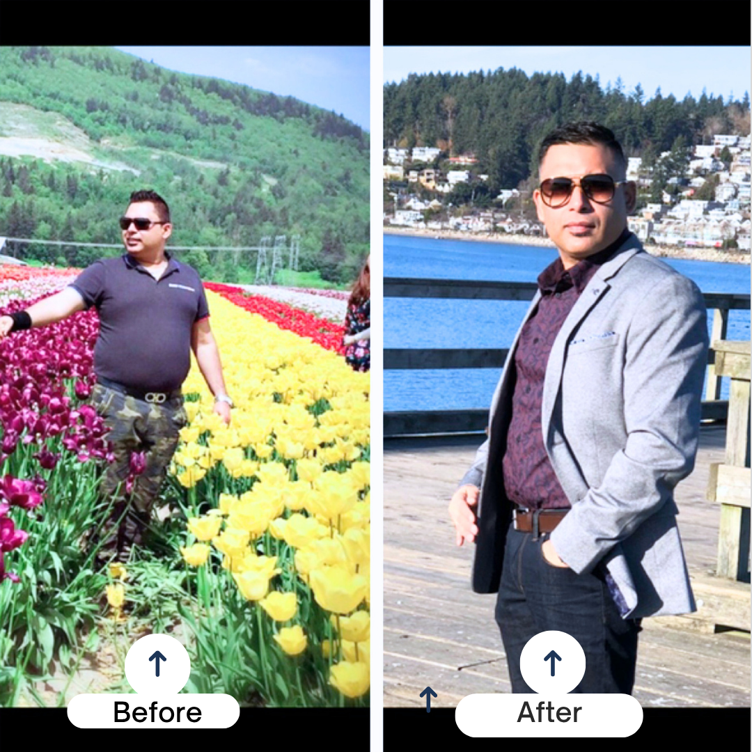 Harry Arora Before and After