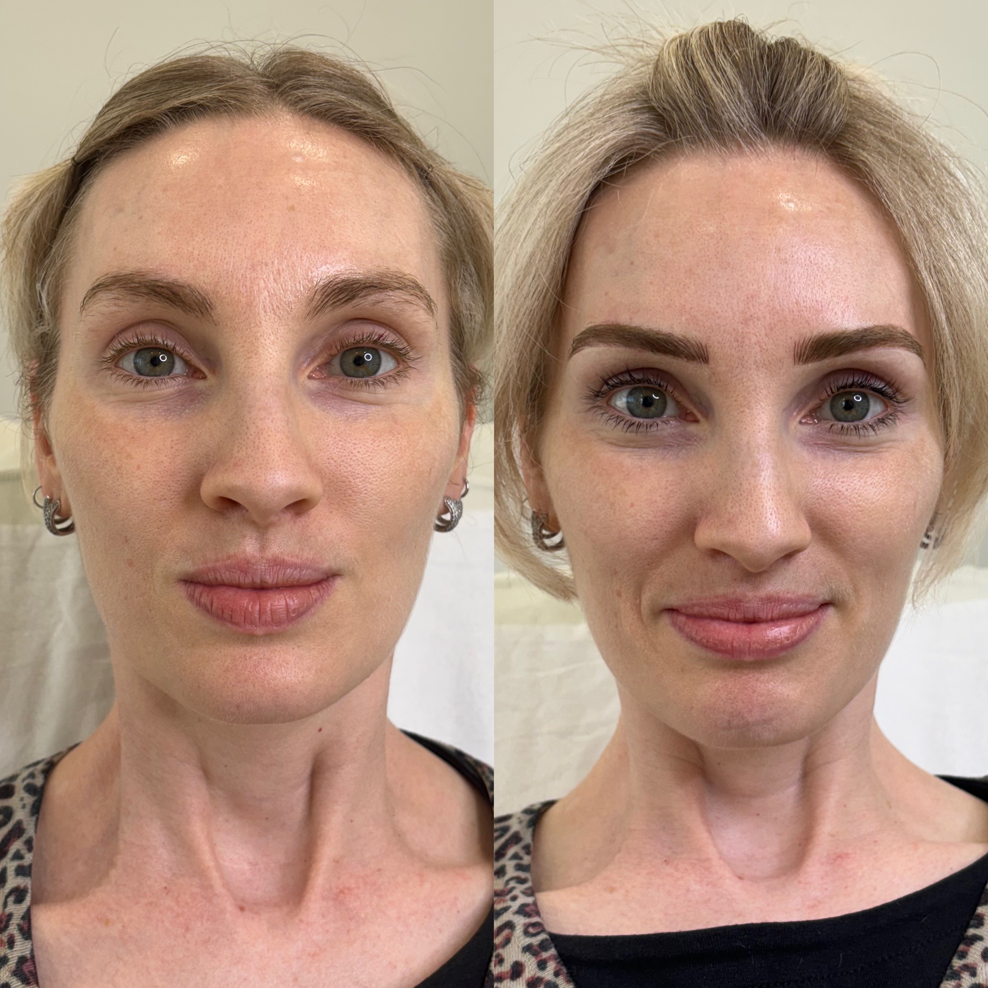 Brow transformation result