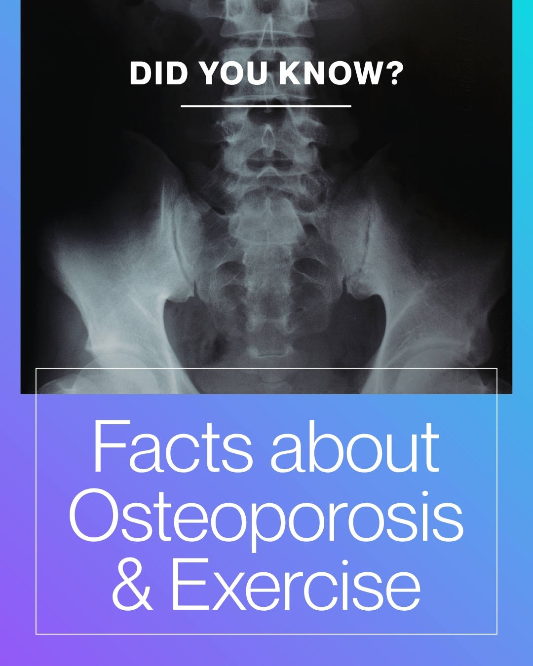 Senior Bone Health: 10 Osteoporosis Facts Everyone Over 50 Should Know