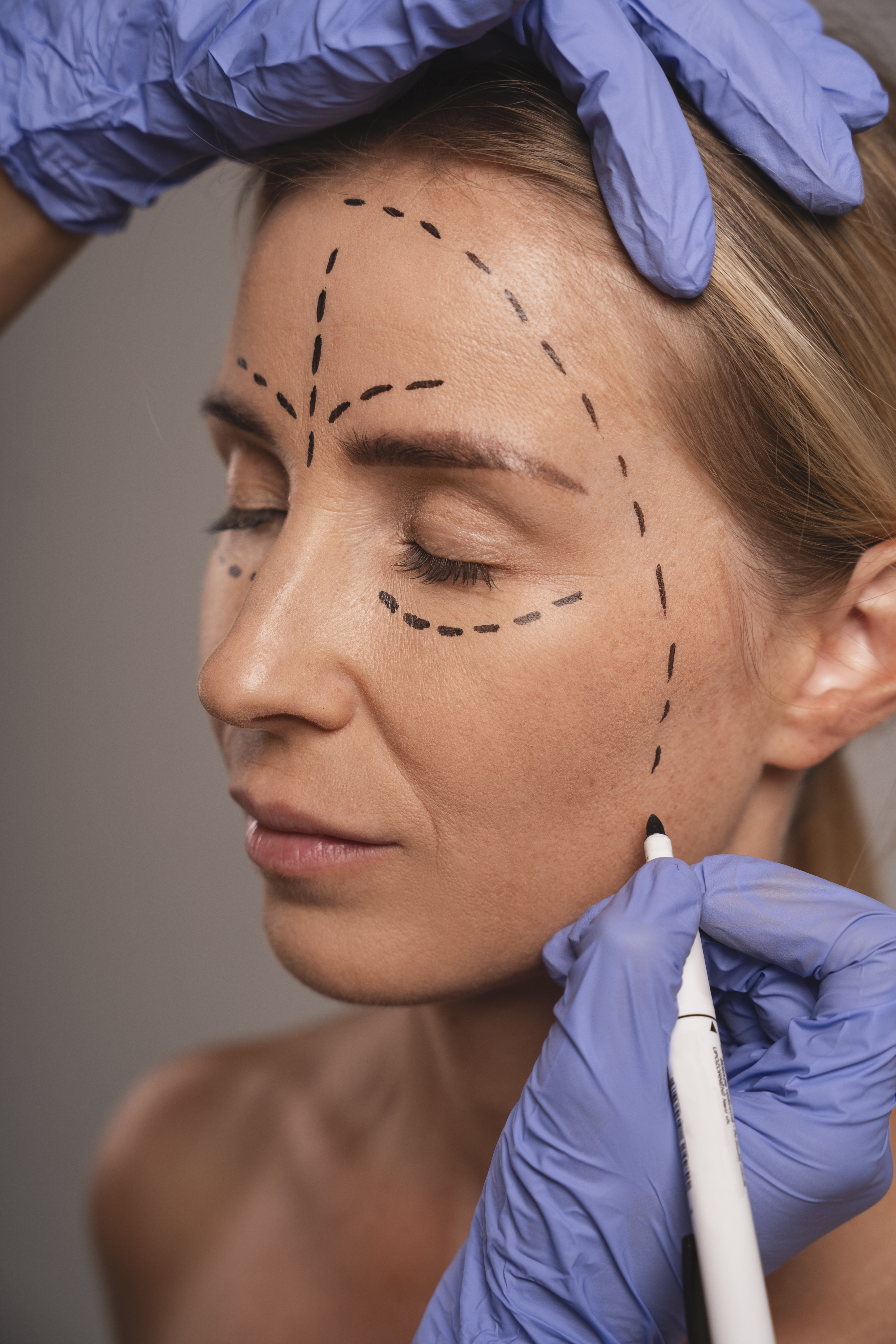 Cirugía Facial