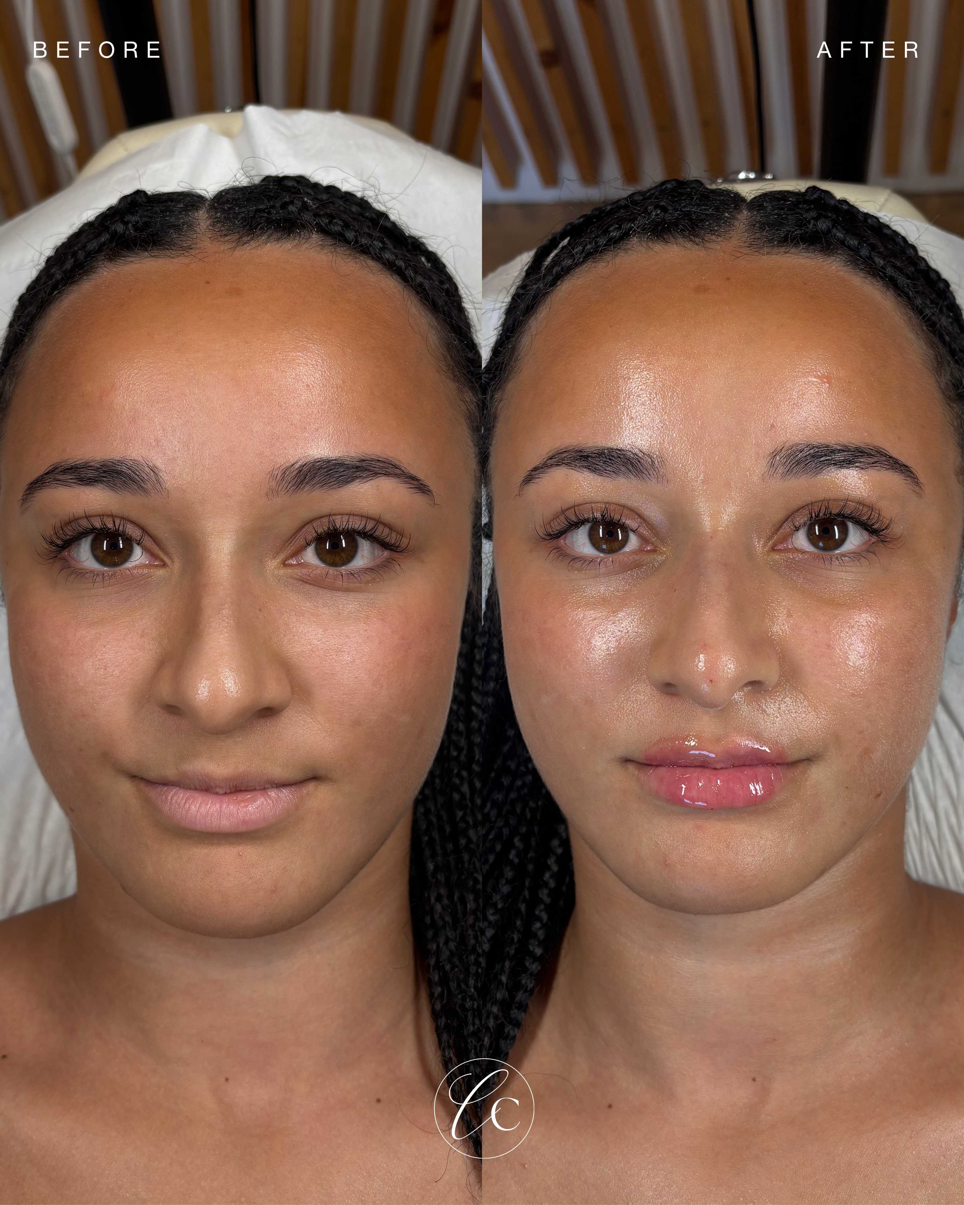 Cave Clinic result