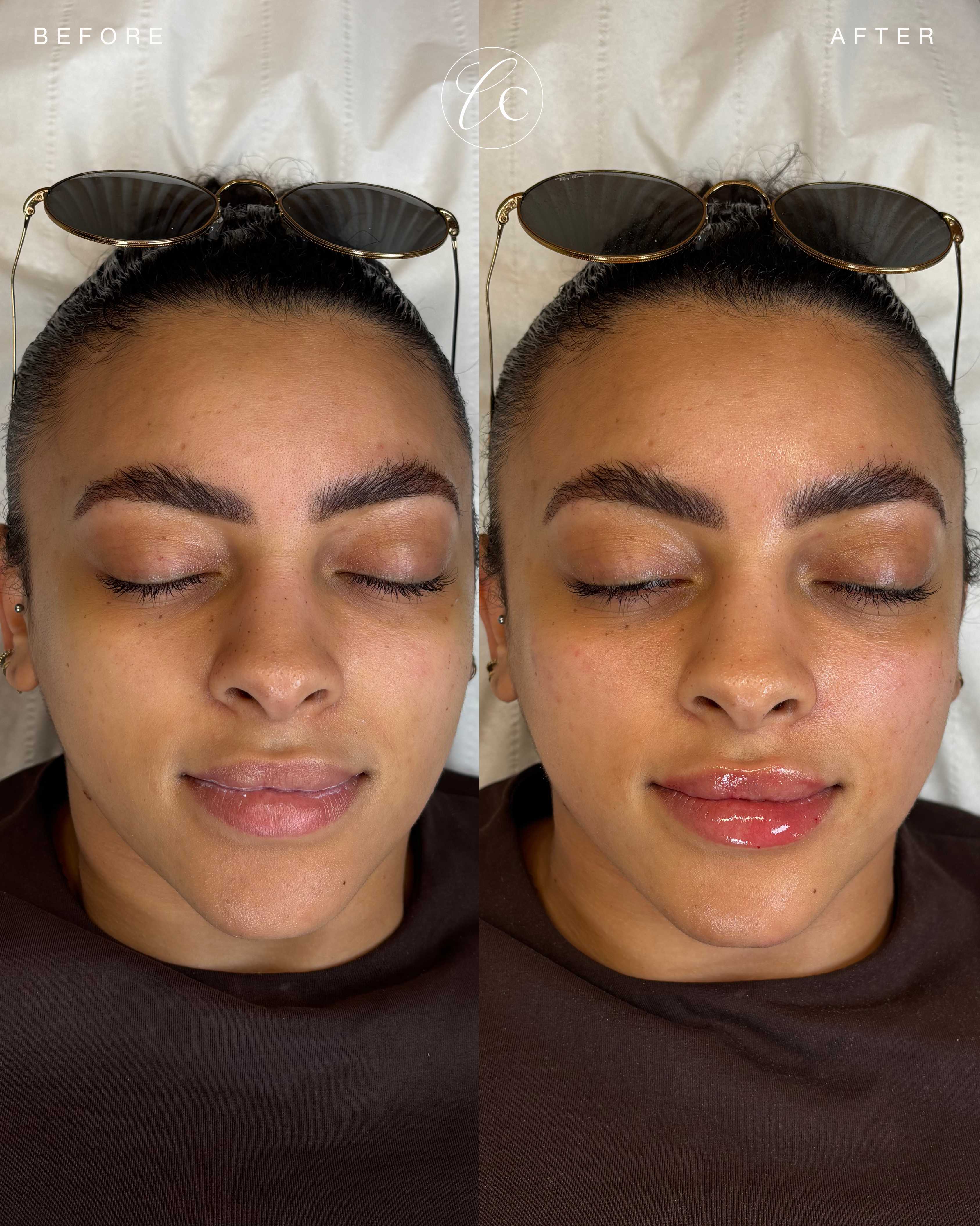 Cave Clinic result