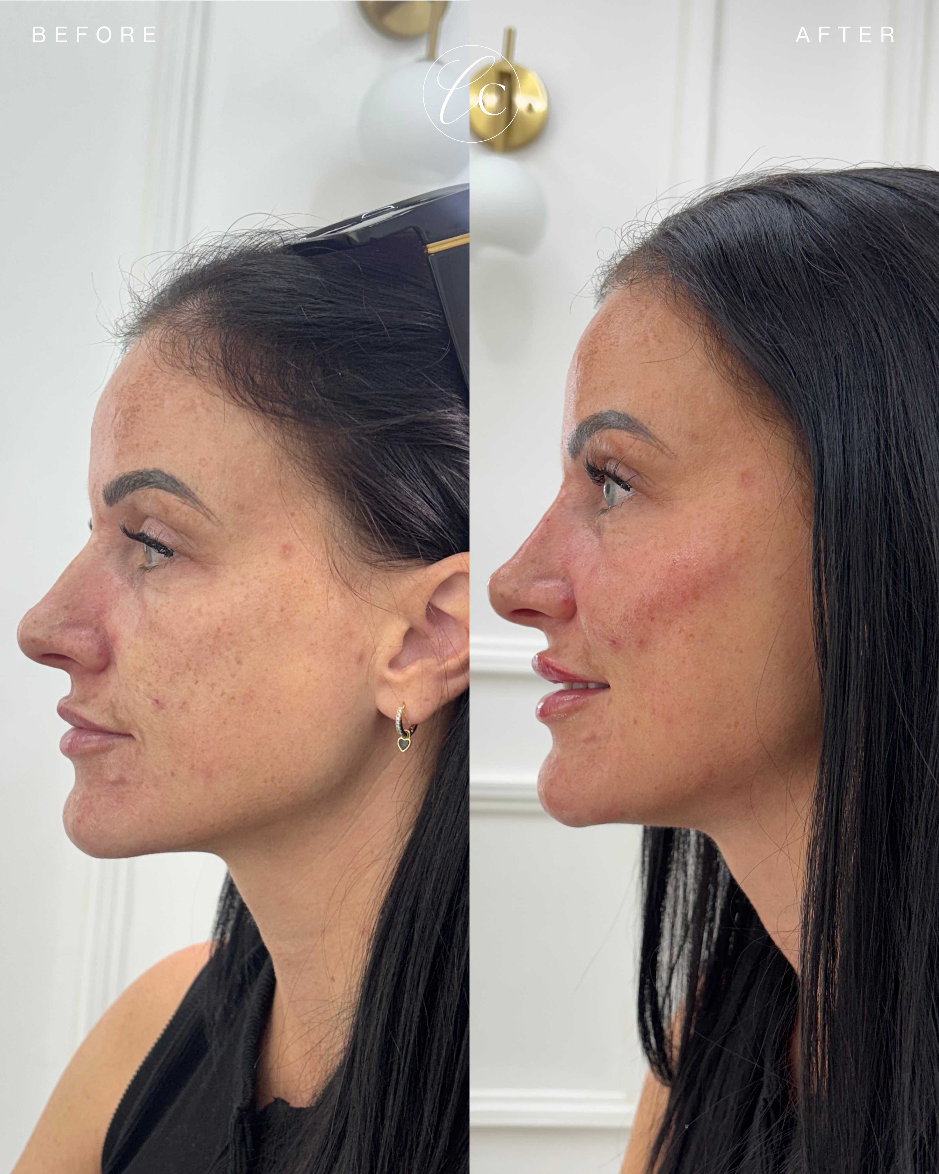 Cave Clinic result