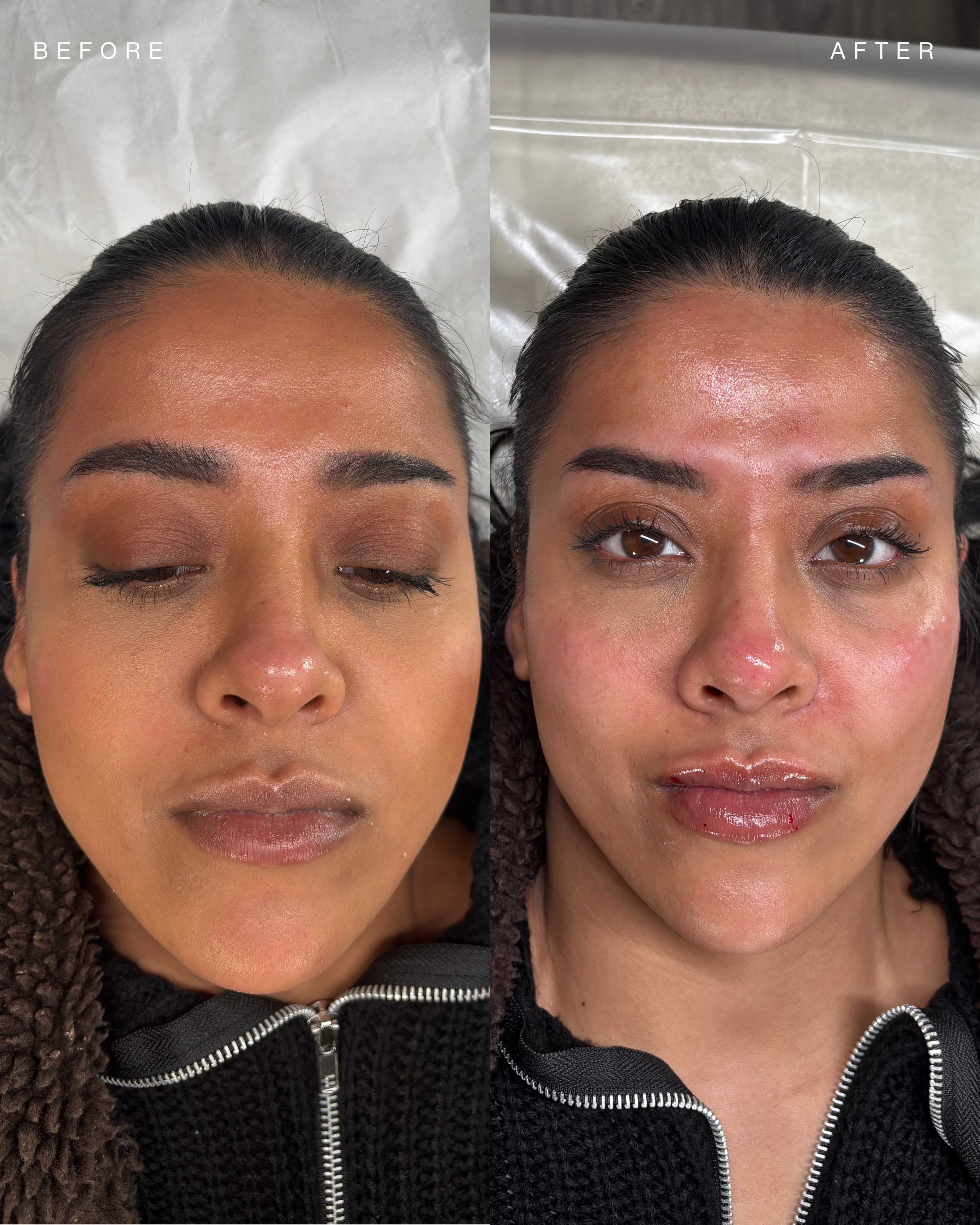 Cave Clinic result