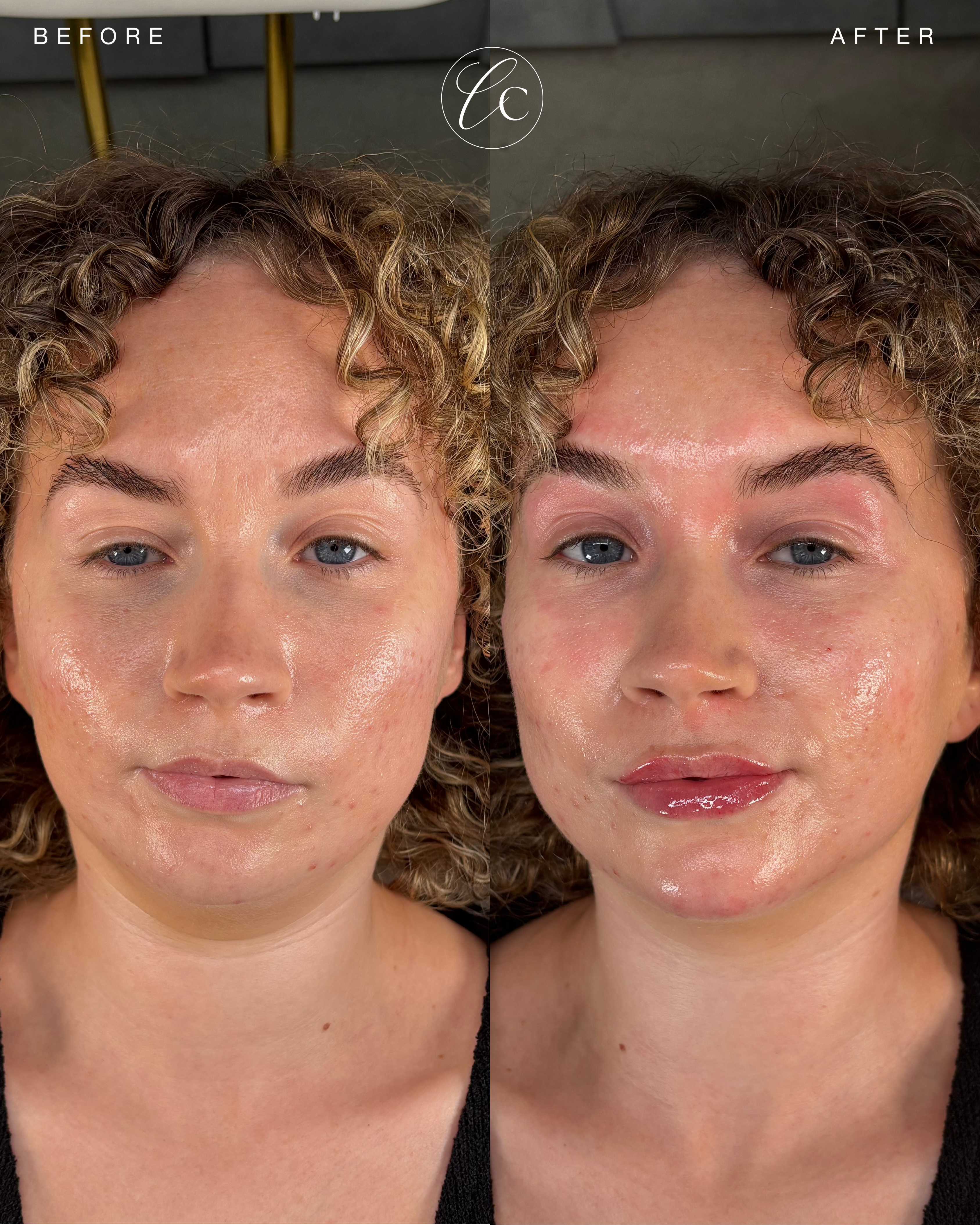 Cave Clinic result