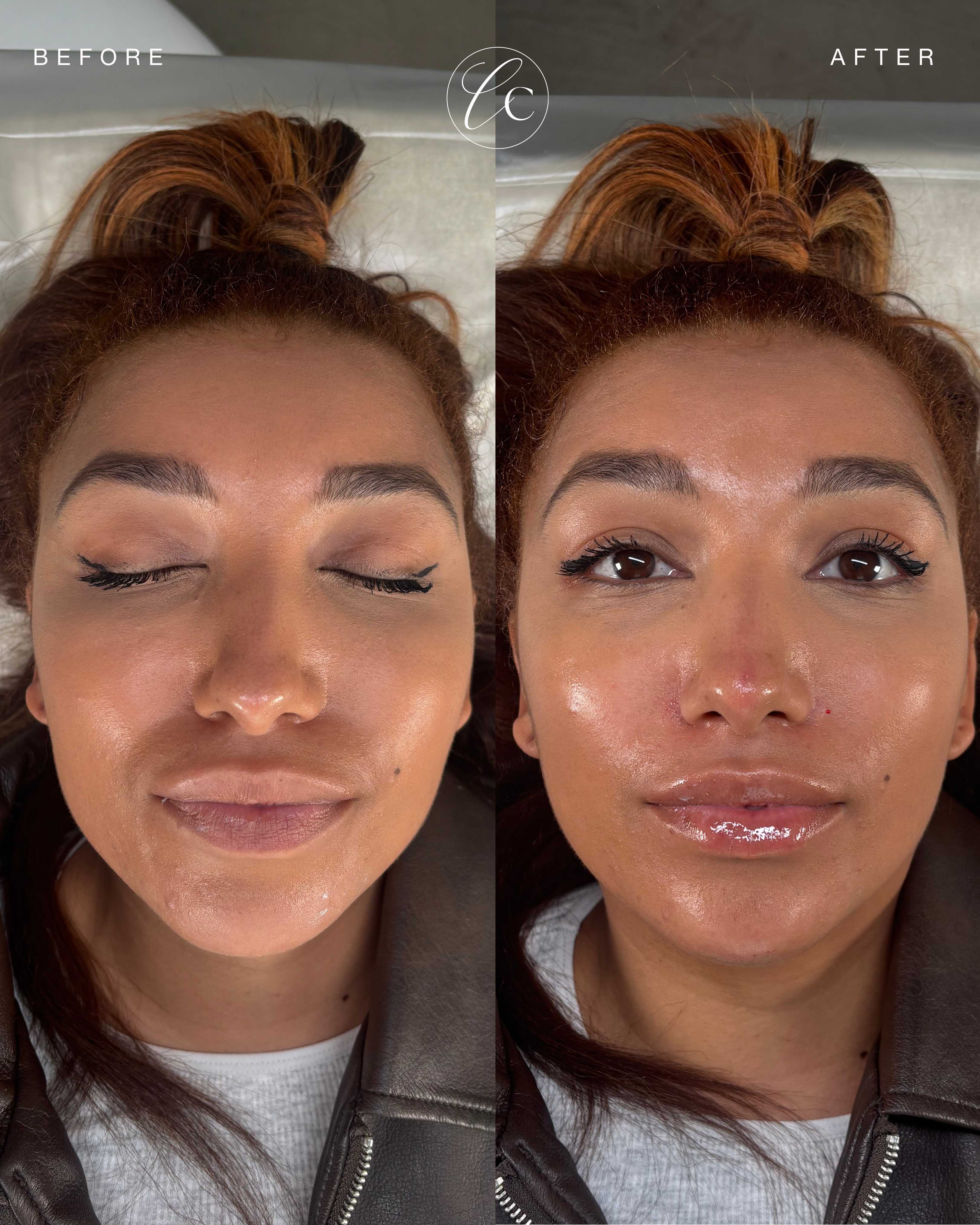 Cave Clinic result