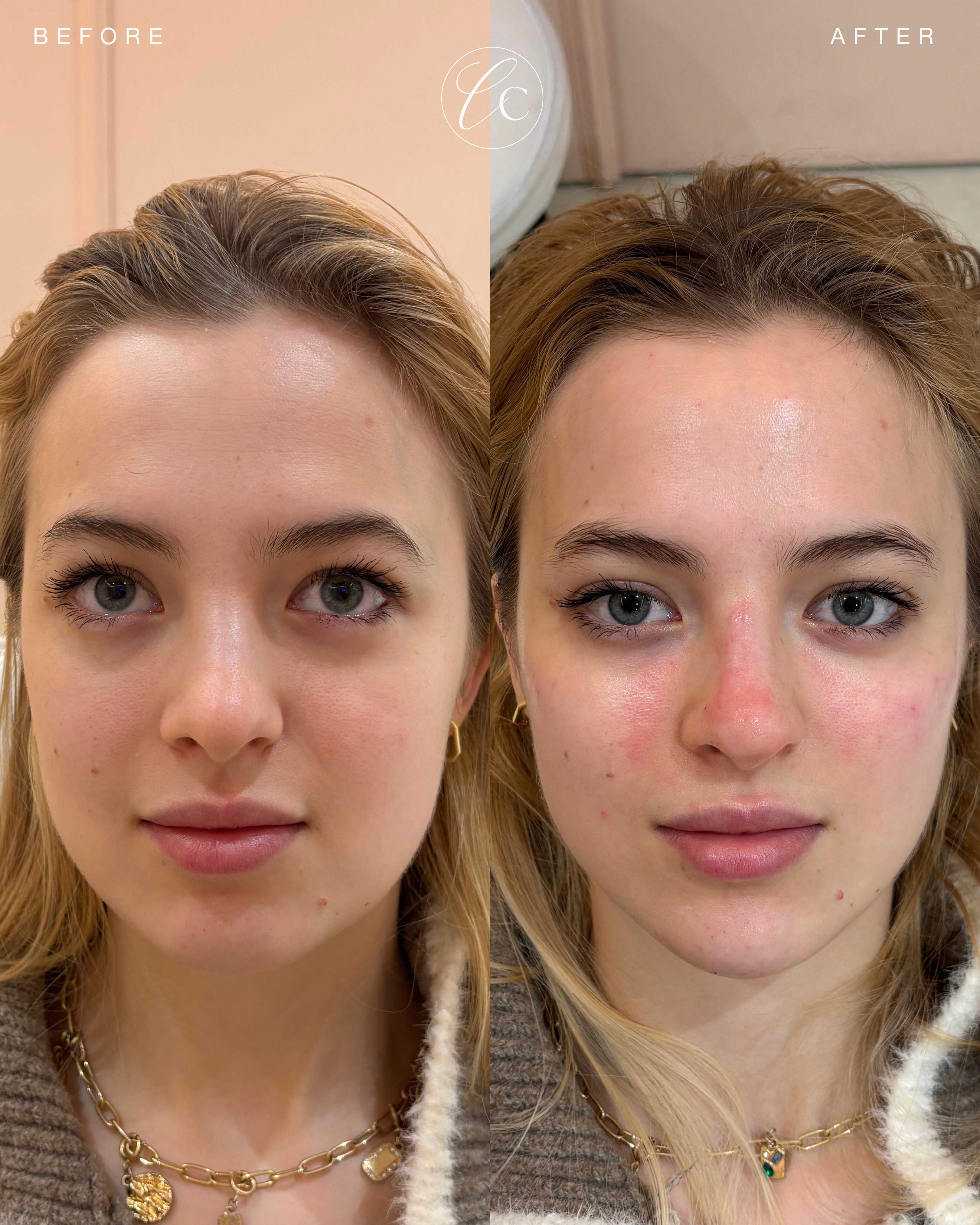 Cave Clinic result