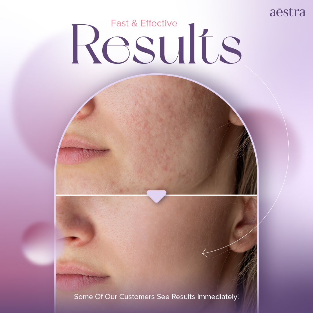 LDM skin treatment before and after
