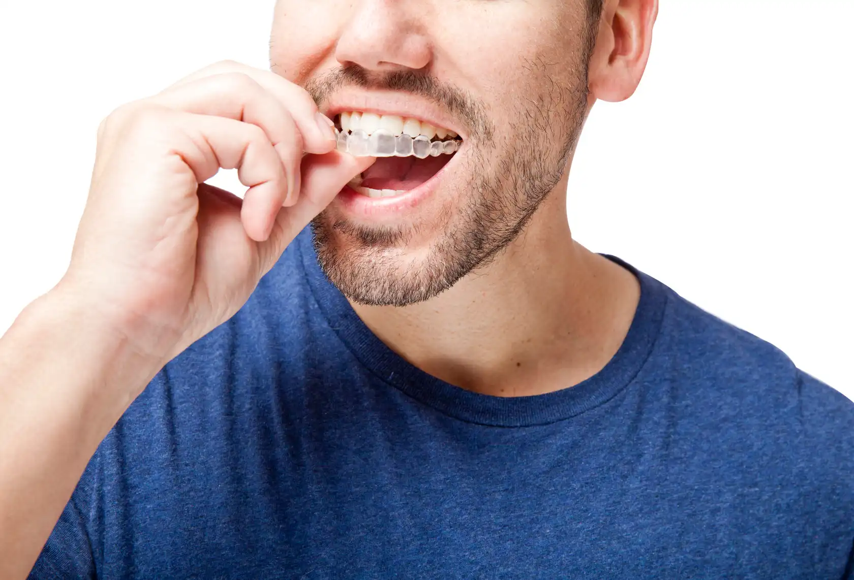 face of orthodontics