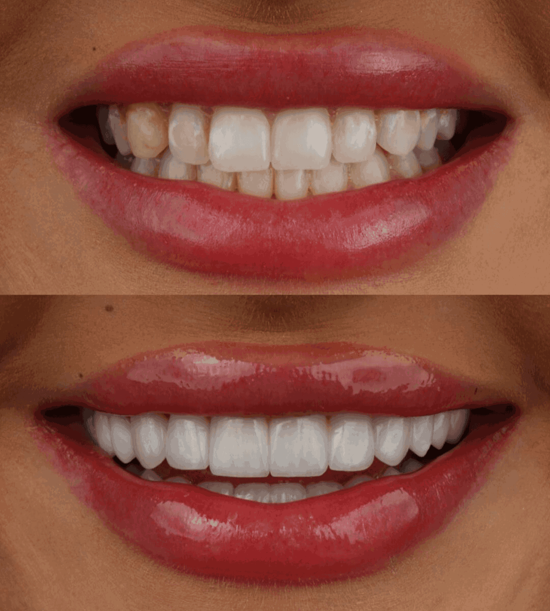 smile phase