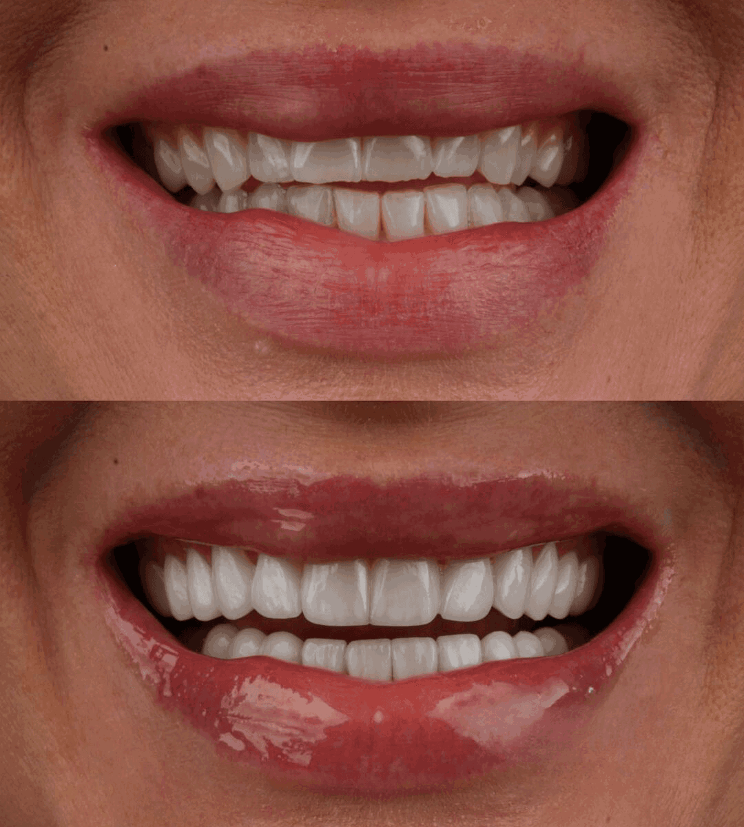 smile phase