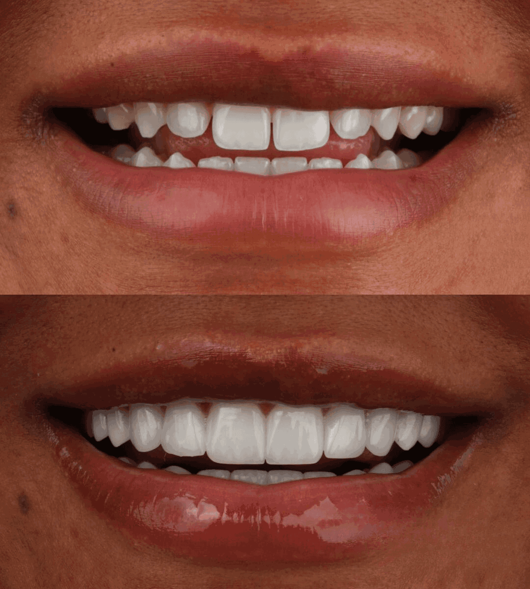 smile phase
