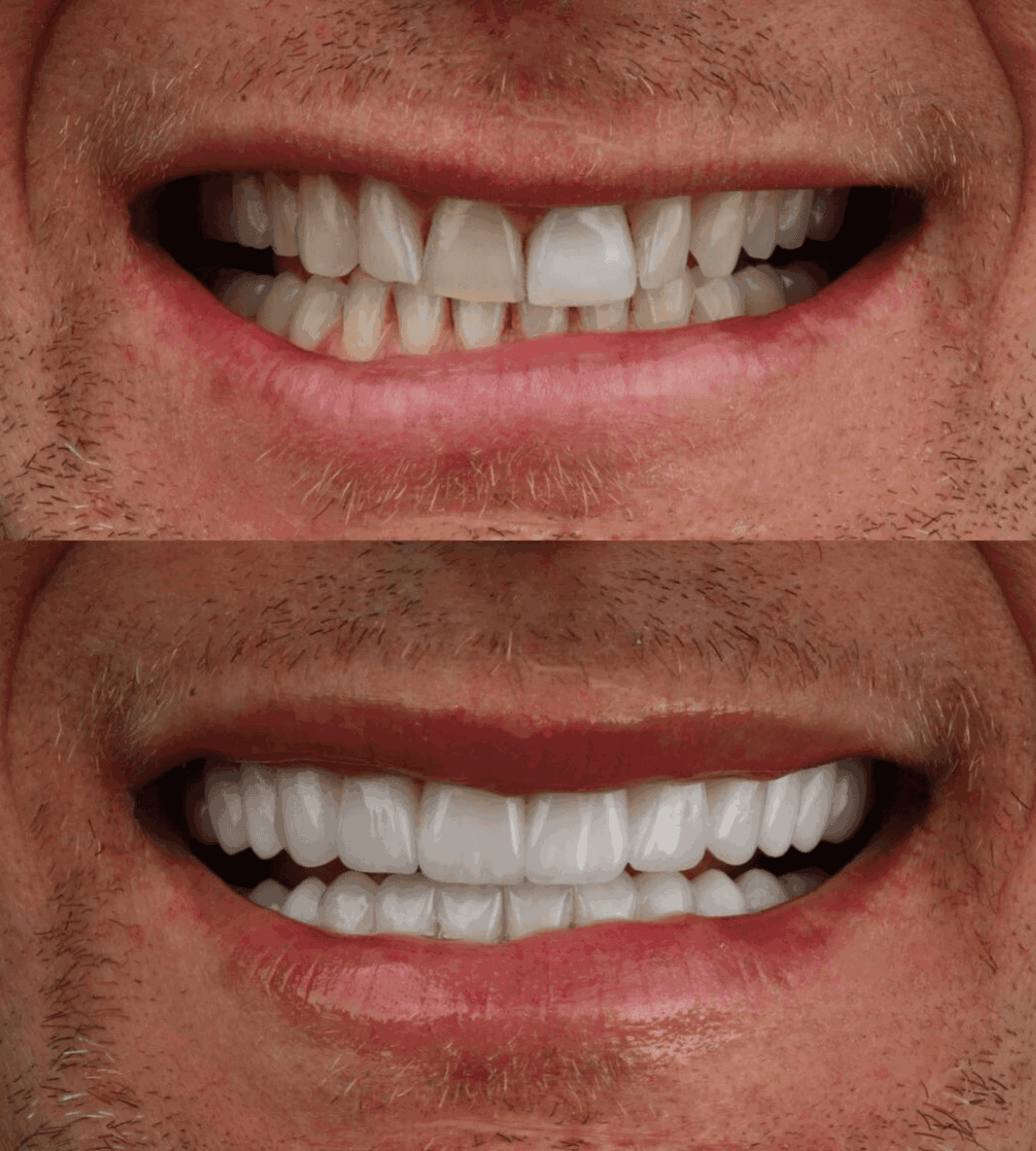 smile phase