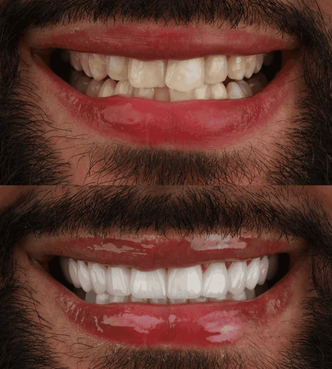 smile phase