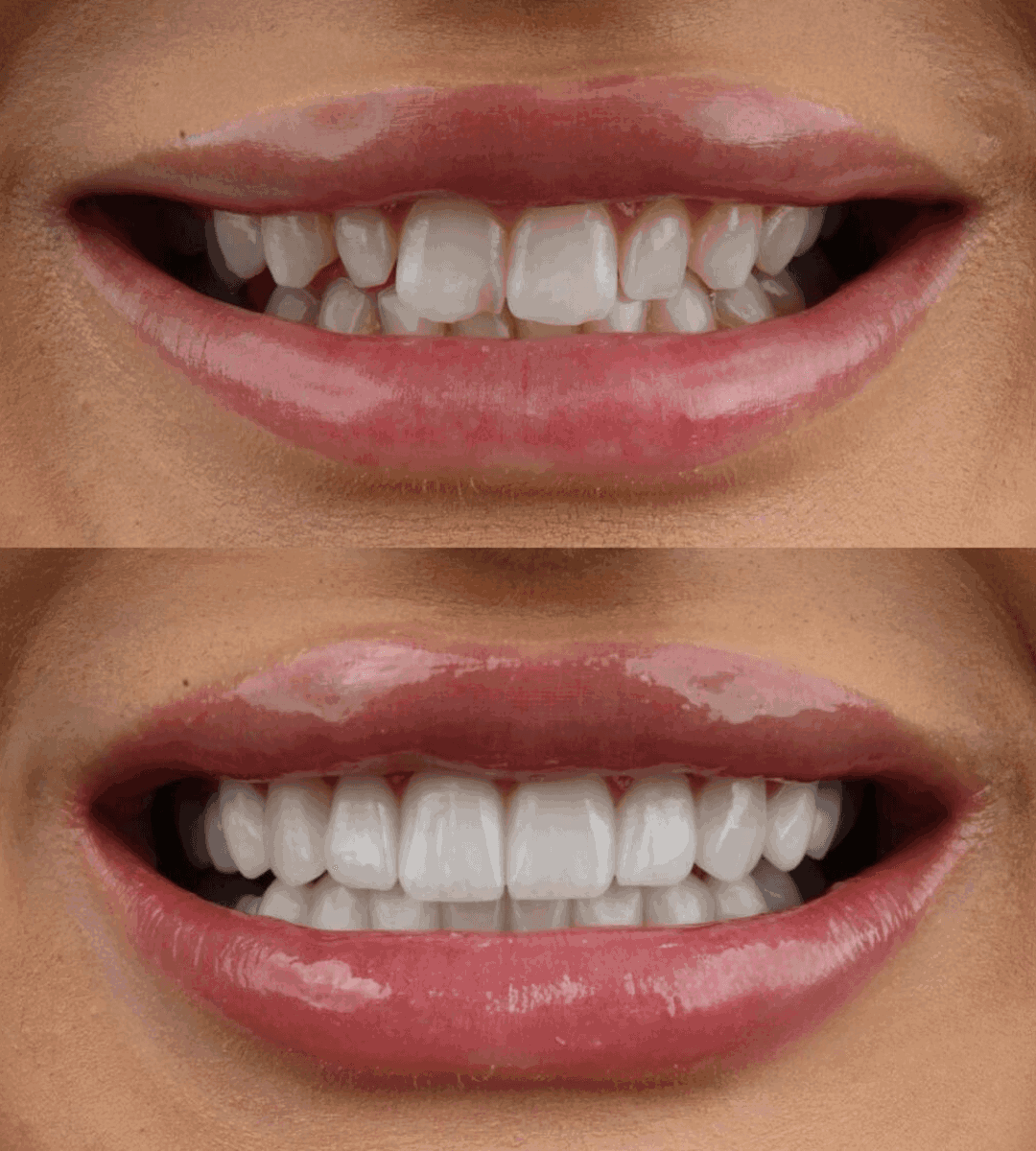smile phase