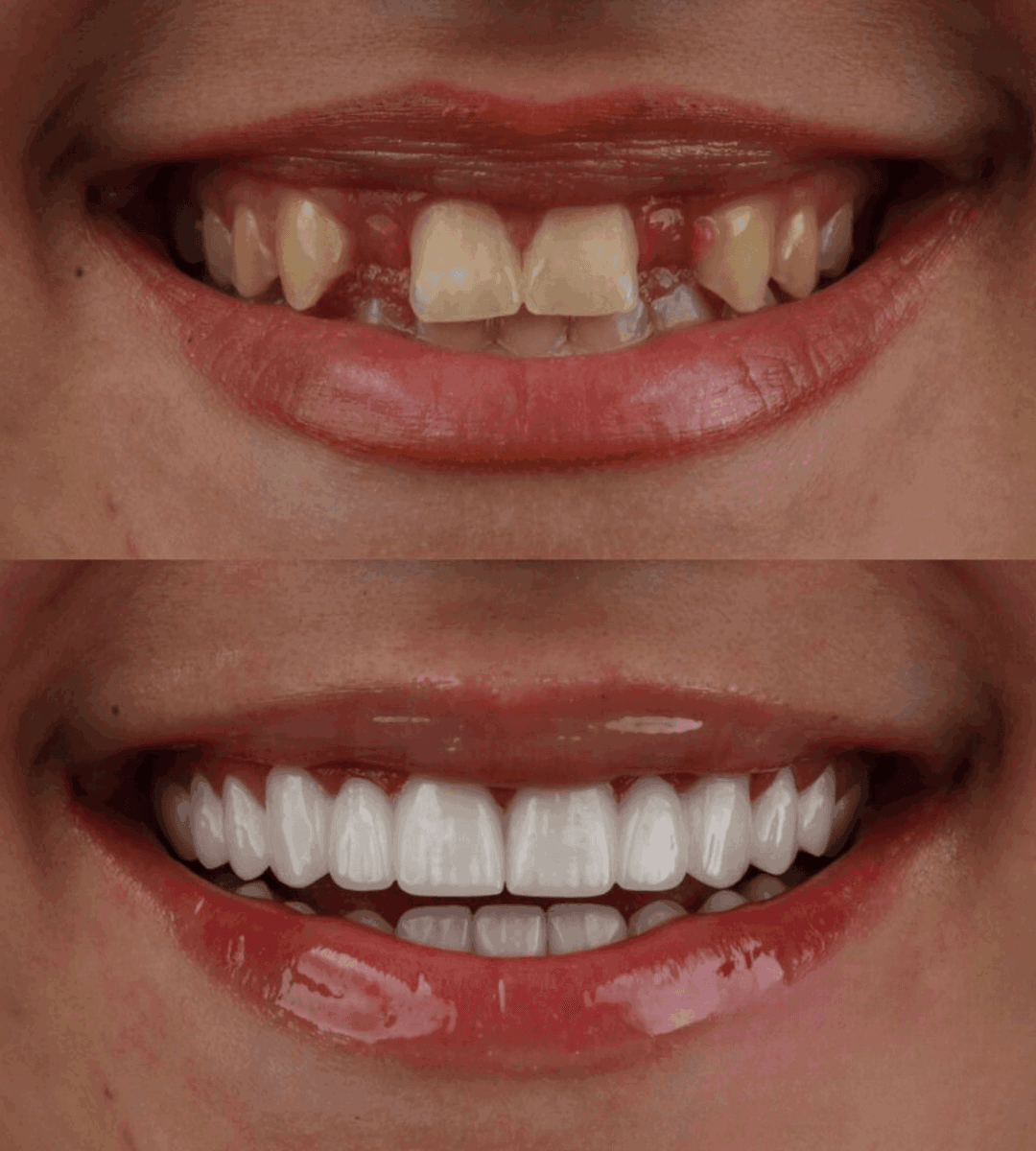 smile phase