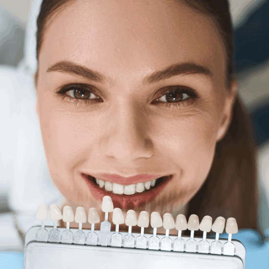 smile makeover